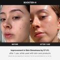 Medicube Age-R Booster H – Facial Glow Booster